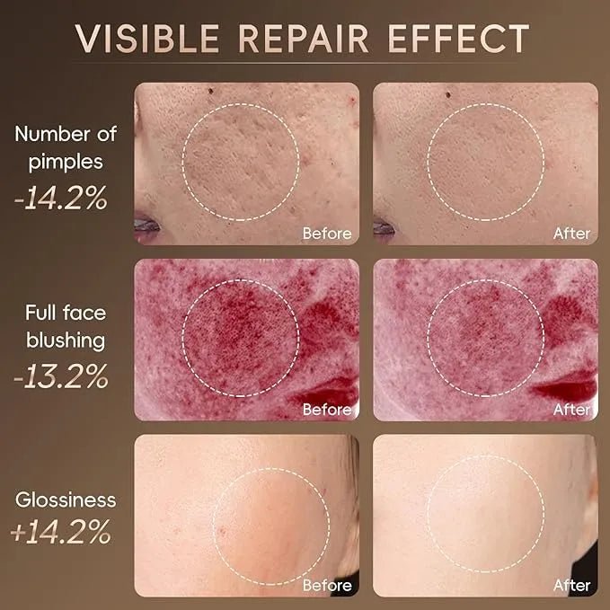 Light Therapy Face Mask - Carbone's Marketplace